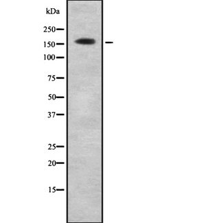 COL4A6 / Collagen IV Antibody - Western blot analysis of COL4A6 using K562 whole cells lysates