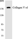 COL5A1 / Collagen V Alpha 1 Antibody - Western blot analysis of the lysates from HUVECcells using Collagen V Î±1 antibody.
