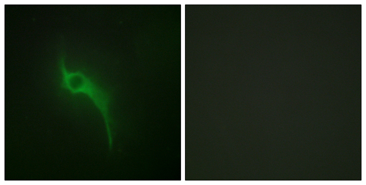 COL5A1 / Collagen V Alpha 1 Antibody - Immunofluorescence analysis of HeLa cells, using Collagen V alpha1 Antibody. The picture on the right is blocked with the synthesized peptide.