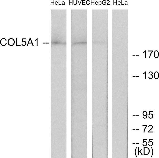 COL5A1 / Collagen V Alpha 1 Antibody - Western blot analysis of lysates from HeLa, and HUVEC, and HepG2 cells, using Collagen V alpha1 Antibody. The lane on the right is blocked with the synthesized peptide.
