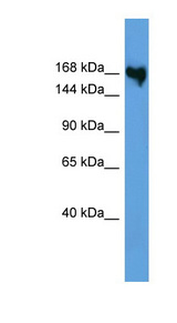 COL5A1 / Collagen V Alpha 1 Antibody - COL5A1 antibody Western blot of MCF7 cell lysate.  This image was taken for the unconjugated form of this product. Other forms have not been tested.