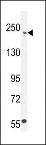 COL5A1 / Collagen V Alpha 1 Antibody - COL5A1 Antibody western blot of U251 cell line lysates (35 ug/lane). The COL5A1 antibody detected the COL5A1 protein (arrow).