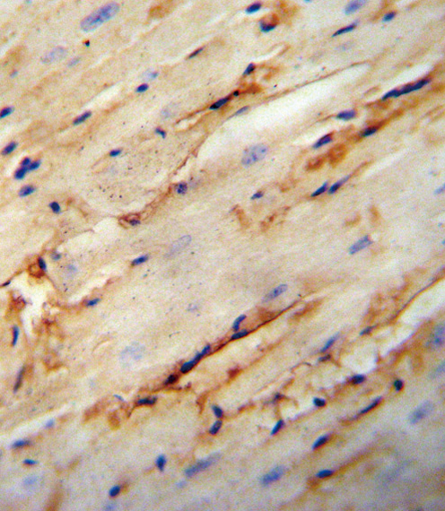 COL5A1 / Collagen V Alpha 1 Antibody - COL5A1 antibody immunohistochemistry of formalin-fixed and paraffin-embedded mouse heart tissue followed by peroxidase-conjugated secondary antibody and DAB staining.
