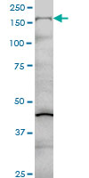 COL5A1 / Collagen V Alpha 1 Antibody - COL5A1 monoclonal antibody (M01), clone 2F4 Western Blot analysis of COL5A1 expression in HeLa NE.