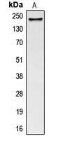 COL5A1 / Collagen V Alpha 1 Antibody - Western blot analysis of Collagen 5 alpha 1 expression in HeLa (A) whole cell lysates.