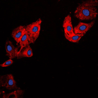 COL5A1 / Collagen V Alpha 1 Antibody - Immunofluorescent analysis of Collagen 5 alpha 1 staining in HeLa cells. Formalin-fixed cells were permeabilized with 0.1% Triton X-100 in TBS for 5-10 minutes and blocked with 3% BSA-PBS for 30 minutes at room temperature. Cells were probed with the primary antibody in 3% BSA-PBS and incubated overnight at 4 C in a humidified chamber. Cells were washed with PBST and incubated with a DyLight 594-conjugated secondary antibody (red) in PBS at room temperature in the dark. DAPI was used to stain the cell nuclei (blue).