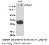 COL5A1 / Collagen V Alpha 1 Antibody - Western blot.