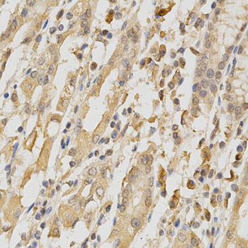 COL5A1 / Collagen V Alpha 1 Antibody - Immunohistochemistry of paraffin-embedded human stomach using COL5A1 antibody at dilution of 1:200 (x400 lens)