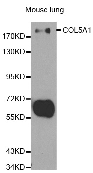 COL5A1 / Collagen V Alpha 1 Antibody - Western blot analysis of extracts of mouse lung, using COL5A1 antibody at 1:500 dilution. The secondary antibody used was an HRP Goat Anti-Rabbit IgG (H+L) at 1:10000 dilution. Lysates were loaded 25ug per lane and 3% nonfat dry milk in TBST was used for blocking.