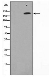 COL5A1 / Collagen V Alpha 1 Antibody - Western blot of HeLa cell lysate using Collagen Valpha 1 Antibody