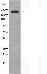 COL5A1 / Collagen V Alpha 1 Antibody - Western blot analysis of extracts of HeLa cells using Collagen V a1 antibody.