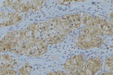 COL5A1 / Collagen V Alpha 1 Antibody - 1:100 staining human uterus tissue by IHC-P. The sample was formaldehyde fixed and a heat mediated antigen retrieval step in citrate buffer was performed. The sample was then blocked and incubated with the antibody for 1.5 hours at 22°C. An HRP conjugated goat anti-rabbit antibody was used as the secondary.