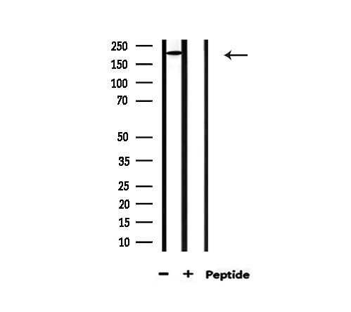 COL5A1 / Collagen V Alpha 1 Antibody - Western blot analysis of extracts of HeLa cells using Collagen Valpha 1 antibody.