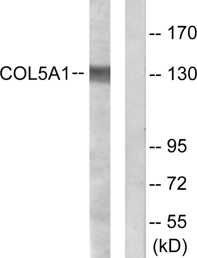 COL5A1 / Collagen V Alpha 1 Antibody - Western blot analysis of extracts from HeLa cells, using Collagen V a1 antibody.