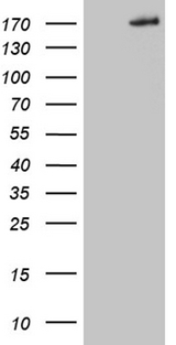 COL5A2 / Collagen V Alpha 2 Antibody - HEK293T cells were transfected with the pCMV6-ENTRY control. (Left lane) or pCMV6-ENTRY COL5A2. (Right lane) cDNA for 48 hrs and lysed. Equivalent amounts of cell lysates. (5 ug per lane) were separated by SDS-PAGE and immunoblotted with anti-COL5A2. (1:2000)