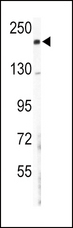 COL5A2 / Collagen V Alpha 2 Antibody - Western blot of COL5A2 Antibody in mouse lung tissue lysates (35 ug/lane). COL5A2 (arrow) was detected using the purified antibody.