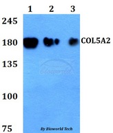COL5A2 / Collagen V Alpha 2 Antibody - Western blot of COL5A2 antibody at 1:500 dilution. Lane 1: HEK293T whole cell lysate. Lane 2: A549 whole cell lysate. Lane 3: PC12 whole cell lysate.