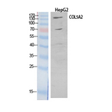 COL5A2 / Collagen V Alpha 2 Antibody - Western Blot analysis of extracts from HepG2 cells using COL5A2 Antibody.