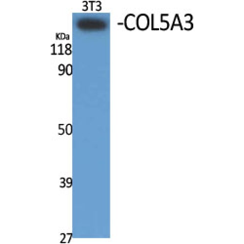 COL5A3 / Collagen V Alpha 3 Antibody - Western blot of COL5A3 antibody