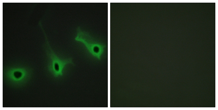 COL5A3 / Collagen V Alpha 3 Antibody - Immunofluorescence analysis of HeLa cells, using Collagen V alpha3 Antibody. The picture on the right is blocked with the synthesized peptide.
