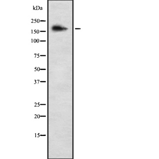 COL5A3 / Collagen V Alpha 3 Antibody - Western blot analysis of COL5A3 using K562 whole cells lysates