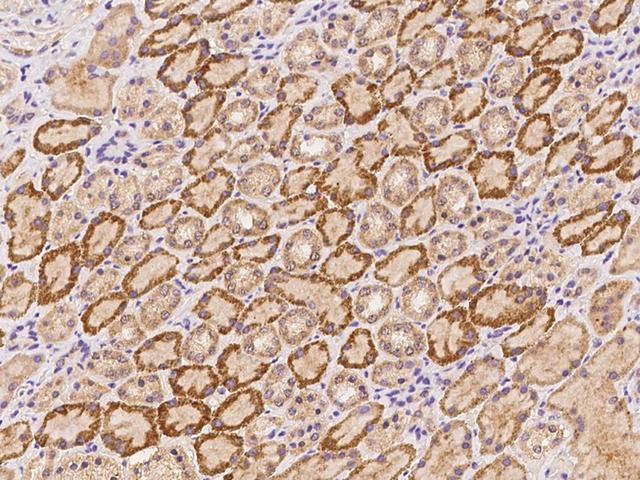 COL5A3 / Collagen V Alpha 3 Antibody - Immunochemical staining of human COL5A3 in human kidney with rabbit polyclonal antibody at 1:300 dilution, formalin-fixed paraffin embedded sections.
