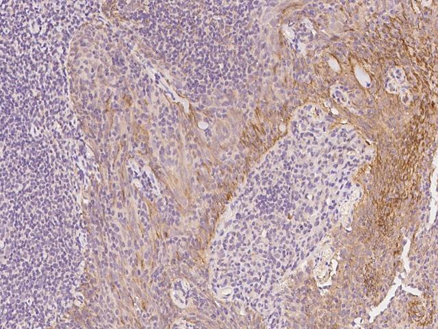 COL5A3 / Collagen V Alpha 3 Antibody - Immunochemical staining of human COL5A3 in human tonsil with rabbit polyclonal antibody at 1:300 dilution, formalin-fixed paraffin embedded sections.