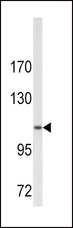 COL6A1 / Collagen VI Alpha 1 Antibody - Western blot of COL6A1 antibody in A2058 cell line lysates (35 ug/lane). COL6A1 (arrow) was detected using the purified antibody.