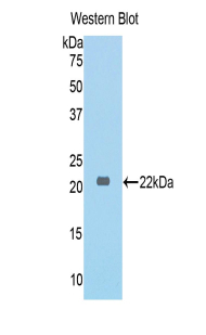 COL6A1 / Collagen VI Alpha 1 Antibody - Western blot of recombinant COL6A1 / Collagen VI.  This image was taken for the unconjugated form of this product. Other forms have not been tested.