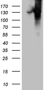 COL6A1 / Collagen VI Alpha 1 Antibody - HEK293T cells were transfected with the pCMV6-ENTRY control. (Left lane) or pCMV6-ENTRY COL6A1. (Right lane) cDNA for 48 hrs and lysed