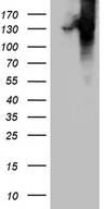 COL6A1 / Collagen VI Alpha 1 Antibody - HEK293T cells were transfected with the pCMV6-ENTRY control. (Left lane) or pCMV6-ENTRY COL6A1. (Right lane) cDNA for 48 hrs and lysed