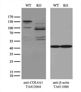 COL6A1 / Collagen VI Alpha 1 Antibody - Equivalent amounts of cell lysates  and COL6A1-Knockout 293T cells  were separated by SDS-PAGE and immunoblotted with anti-COL6A1 monoclonal antibody(1:500). Then the blotted membrane was stripped and reprobed with anti-b-actin antibody  as a loading control.