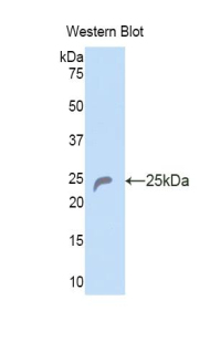 COL6A1 / Collagen VI Alpha 1 Antibody - Western blot of recombinant COL6A1 / Collagen VI.  This image was taken for the unconjugated form of this product. Other forms have not been tested.