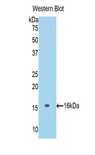 COL6A1 / Collagen VI Alpha 1 Antibody - Western blot of recombinant COL6A1 / Collagen VI.  This image was taken for the unconjugated form of this product. Other forms have not been tested.