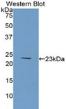 COL6A1 / Collagen VI Alpha 1 Antibody - Western blot of recombinant COL6A1 / Collagen VI.