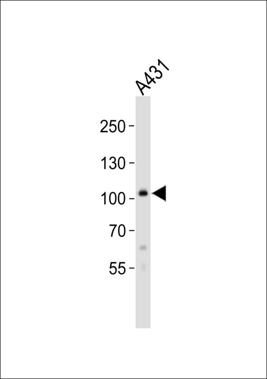 COL6A1 / Collagen VI Alpha 1 Antibody - Western blot of lysate from A431 cell line, using COL6A1 Antibody. Antibody was diluted at 1:1000. A goat anti-rabbit IgG H&L (HRP) at 1:10000 dilution was used as the secondary antibody. Lysate at 20ug.