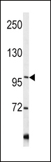 COL6A1 / Collagen VI Alpha 1 Antibody - Western blot of COL6A1 antibody in Y79 cell line lysates (35 ug/lane). COL6A1 (arrow) was detected using the purified antibody.