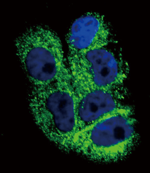 COL6A1 / Collagen VI Alpha 1 Antibody - Confocal immunofluorescence of COL6A1 Antibody with A2058 cell followed by Alexa Fluor 488-conjugated goat anti-rabbit lgG (green). DAPI was used to stain the cell nuclear (blue).
