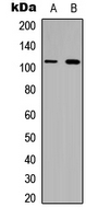 COL6A1 / Collagen VI Alpha 1 Antibody - Western blot analysis of Collagen 6 alpha 1 expression in HeLa (A); H9C2 (B) whole cell lysates.