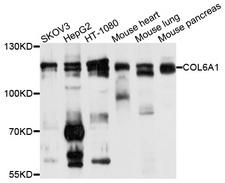 COL6A1 / Collagen VI Alpha 1 Antibody - Western blot analysis of extracts of various cells.