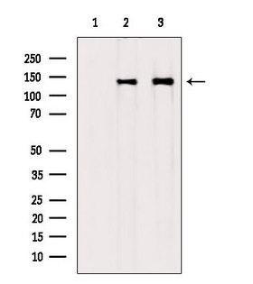 COL6A1 / Collagen VI Alpha 1 Antibody - Western blot analysis of extracts of various samples using Collagen Type VI antibody. Lane 1: rat heart treated with blocking peptide. Lane 2: rat heart; Lane 3: mouse brain;