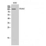COL6A2 / Collagen VI Alpha 2 Antibody - Western blot of COL6A2 antibody