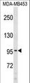 COL6A2 / Collagen VI Alpha 2 Antibody - COL6A2 Antibody western blot of MDA-MB453 cell line lysates (35 ug/lane). The COL6A2 antibody detected the COL6A2 protein (arrow).