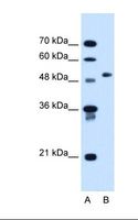 COL6A2 / Collagen VI Alpha 2 Antibody - Lane A: Marker. Lane B: HepG2 cell lysate. Antibody concentration: 1.25 ug/ml. Gel concentration: 12%.  This image was taken for the unconjugated form of this product. Other forms have not been tested.