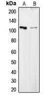COL6A2 / Collagen VI Alpha 2 Antibody - Western blot analysis of Collagen 6 alpha 2 expression in HepG2 (A); HT29 (B) whole cell lysates.