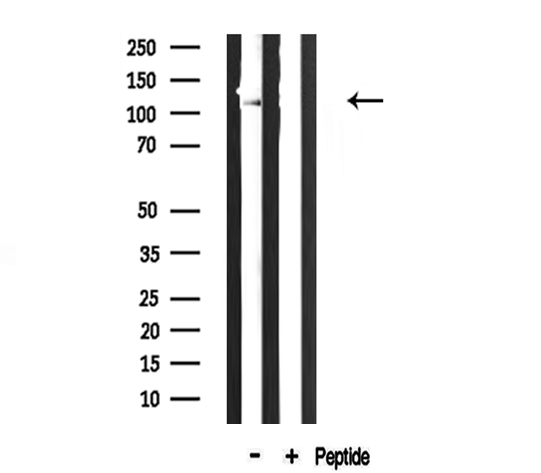 COL6A2 / Collagen VI Alpha 2 Antibody - Western blot analysis of extracts of rat brain tissue using Collagen VI a2 antibody.