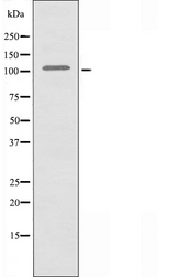 COL6A2 / Collagen VI Alpha 2 Antibody - Western blot analysis of extracts of K562 cells using Collagen VI a2 antibody.