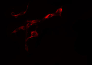 COL6A2 / Collagen VI Alpha 2 Antibody - Staining HeLa cells by IF/ICC. The samples were fixed with PFA and permeabilized in 0.1% Triton X-100, then blocked in 10% serum for 45 min at 25°C. The primary antibody was diluted at 1:200 and incubated with the sample for 1 hour at 37°C. An Alexa Fluor 594 conjugated goat anti-rabbit IgG (H+L) antibody, diluted at 1/600, was used as secondary antibody.