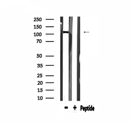 COL6A2 / Collagen VI Alpha 2 Antibody - Western blot analysis of extracts of HepG2 cells using Collagen VI a2 antibody.