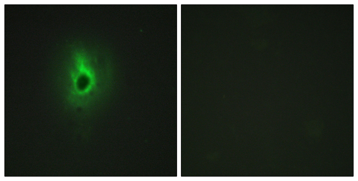 COL6A3 / Collagen VI Alpha 3 Antibody - Immunofluorescence analysis of HeLa cells, using Collagen VI alpha3 Antibody. The picture on the right is blocked with the synthesized peptide.